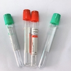 Consumable 	Blood Collecting Tube Tiger Top Customized 1ML-6ML
