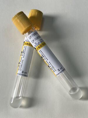 Pıhtı aktivasyonu ve jel bariyeri olan serum ayırıcı tüp (SST)