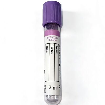 Tam Kan EDTA tüpleri: Hematoloji ve Moleküler Test Bütünlüğü için Önemli